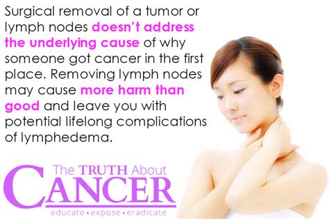 Is Lymph Node Removal With Cancer Surgery Really Necessary