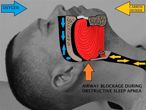 work off that snore the 6 best exercises for sleep apnea fix your sleep today