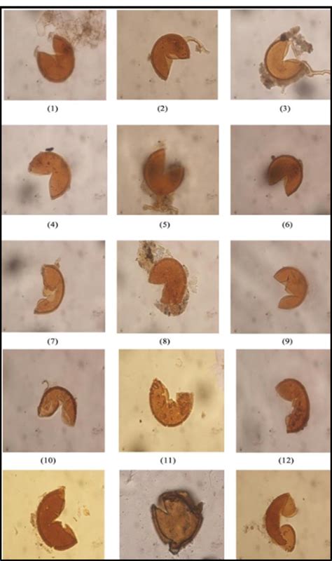 Arbuscular Mycorrhizal Fungi Spores With Glomus Genera At 400