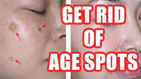 Quick Way To Get Rid Of Age Spots Just For Guide
