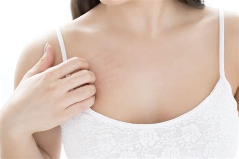 Causes Of Itchy Breasts Beyond Breast Cancer