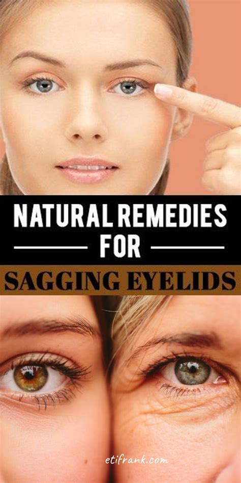 Natural Remedies For Sagging Eyelids Saggy Eyelids Droopy Eyelids