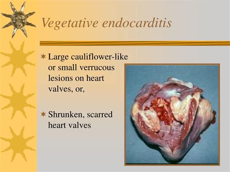 Ppt Food Animal Cardiology Powerpoint Presentation Free Download