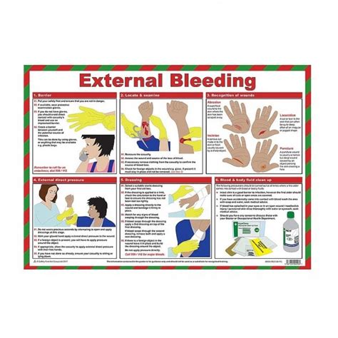 External Bleeding Laminated Poster Safety Posters Parrs