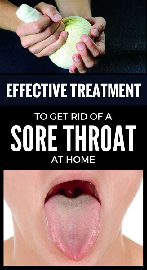 Effective Treatment To Get Rid Of A Sore Throat At Home With Images