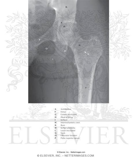Hip Joint Anteroposterior Radiograph