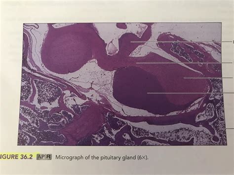 Micrograph Of Pituitary Gland Diagram Quizlet