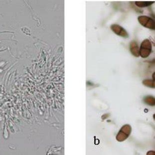 Recent studies on the role of. (PDF) Occurrence of leaf blotch disease (Botryosphaeria Sp ...