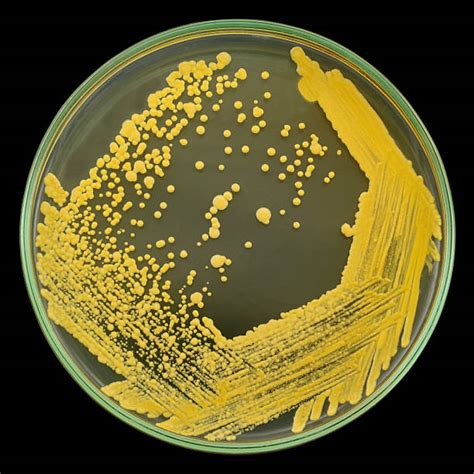 Bacterial Colony Stock Photos Pictures And Royalty Free Images Istock