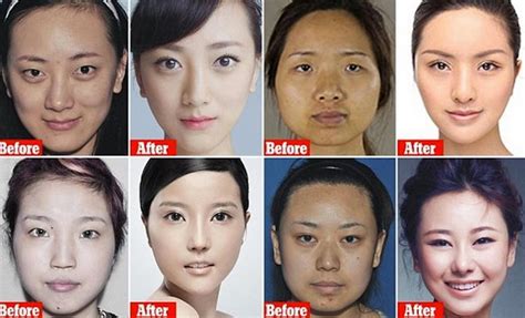 about face china s plastic surgery market grows six times faster than global average china expats