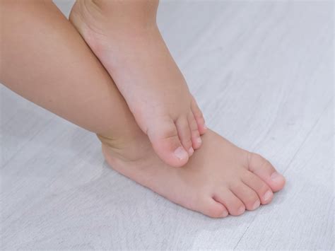 Flat Feet In Adults And Children Highgate Podiatry Biomechanics Orthotics