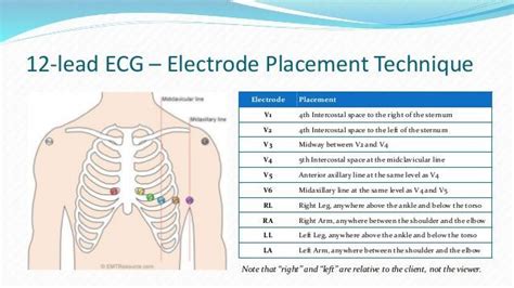 12 Lead Ekg Electrode Placement Ekg Placement Diagnostic Testing Ekg