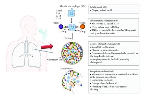 Pathogenesis Of Tuberculosis Tb Pathogenesis Can Be Divided In Four
