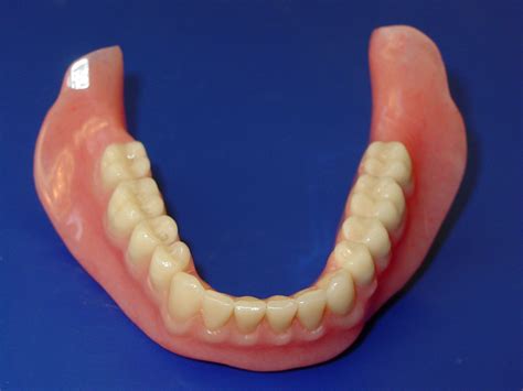 Layman Blog On Health Cosmetic Dentures And Their Types