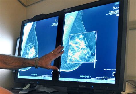 Breast Cancer Screening Fda Proposes Mammogram Changes
