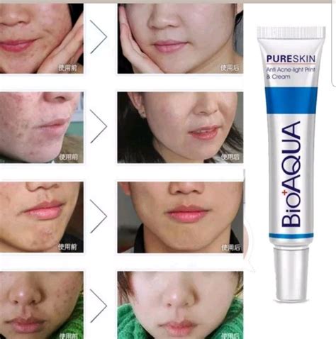Buy Bioaqua Cream Pure Skin Acne Rejuvenation 30g Dmarklk