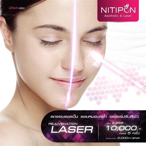 Nitipon Clinic Z Smooth Laser Zs Facebook