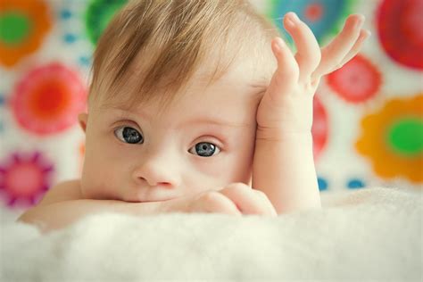 10 Symptoms Of Down Syndrome Facty Health