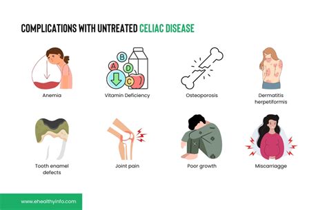 Celiac Disease Symptoms Diagnosis And Treatment E Healthy Info