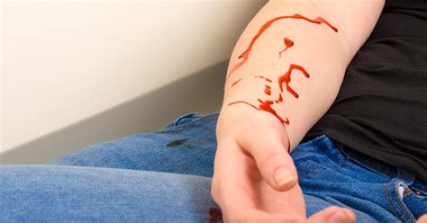 Blood Hurt Hemorrhage Causes Emergency Symptoms First Aid More The