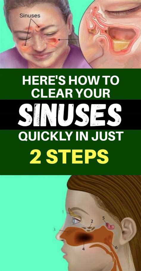 Heres How To Clear Your Sinuses Quickly In Just Two Steps In 2020