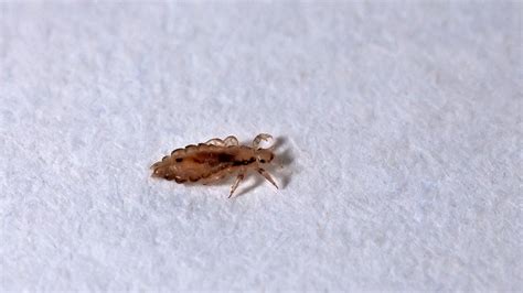 What Does Lice Look Like Laptrinhx News