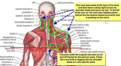 We did not find results for: Best 7 Shoulder Muscle Pain images on Pinterest | Fitness ...