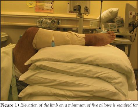 Figure 1 From Elevation As A Treatment For Fasciotomy Wound Closure