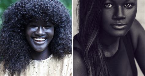 Teen Bullied For Her Dark Skin Color Becomes A Model Bored Panda