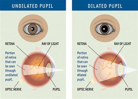 The Importance Of A Dilated Eye Exam Beach Eye Medical Group