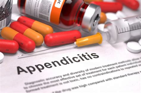 Antibiotics For Appendicitis Not For This Surgeon Heres Why