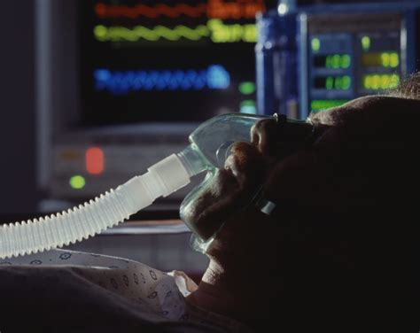 Intensive Care Admissions, Mechanical Ventilation More Likely in Patients With Rheumatic Disease ...