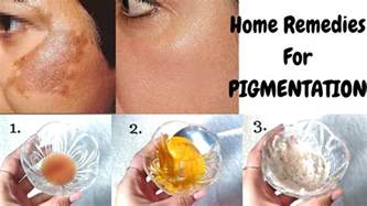 Home Remedies To Get Rid Of Pigmentation In Just 10 Days
