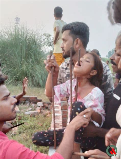 Girl 8 Miraculously Survives Falling Onto Spike That Pierced Through Her Mouth Daily Star