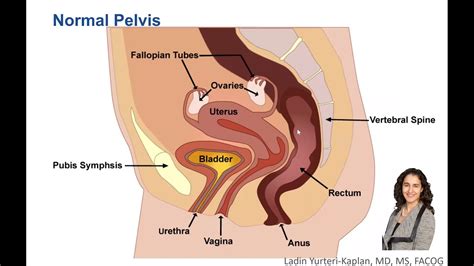 What Is Uterine Prolapse And How Is It Treated Youtube