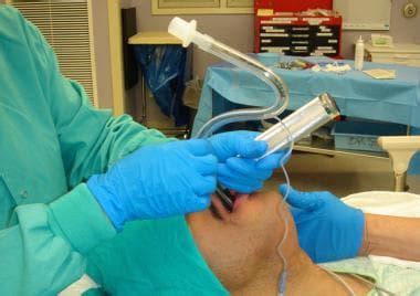 Nasotracheal Intubation Technique Placement Of Nasotracheal Tube