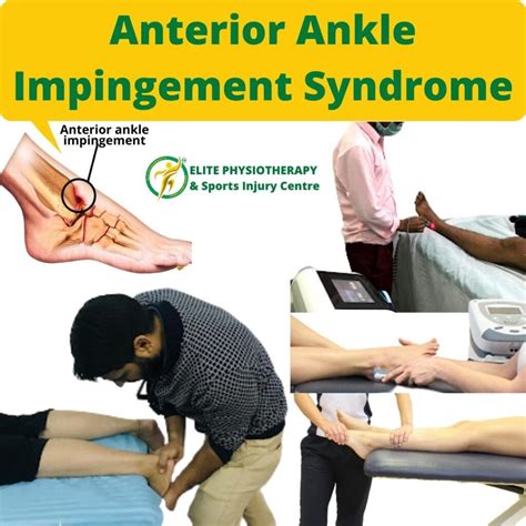Anterior Ankle Impingement Syndrome Elite Physiotherapy