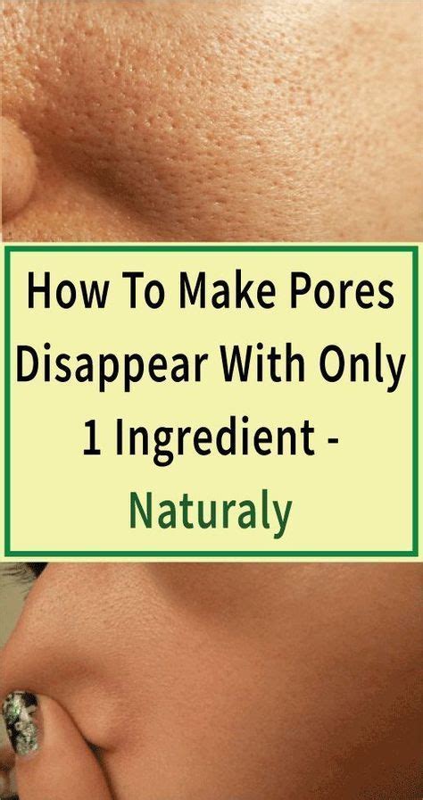How To Make Pores Disappear With Only 1 Ingredient ...