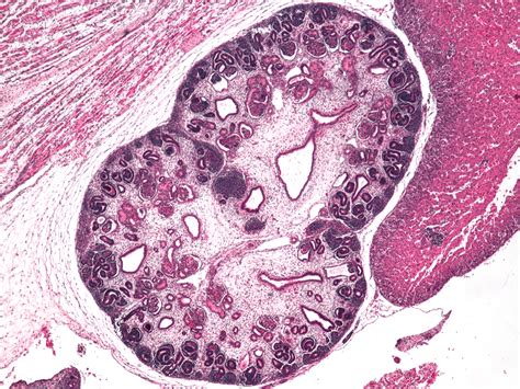 Filehuman Embryo Kidney Wikimedia Commons