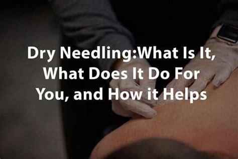 dry needling what is it what does it do for you and how it helps