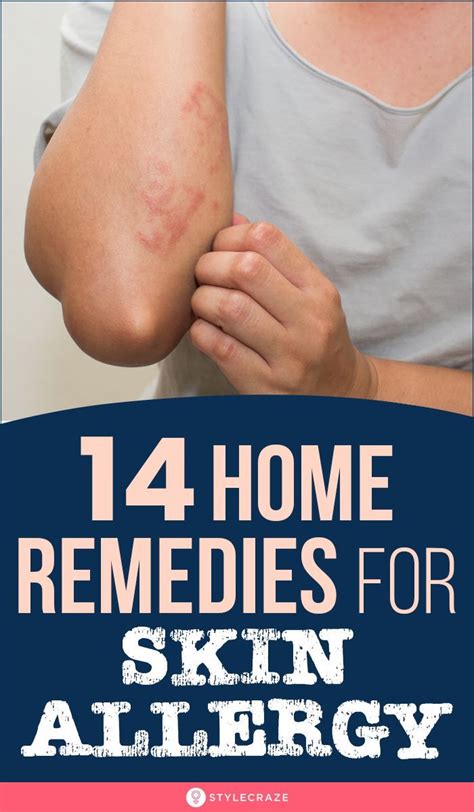 14 Home Remedies For Skin Allergy Causes Symptoms Types And Tips