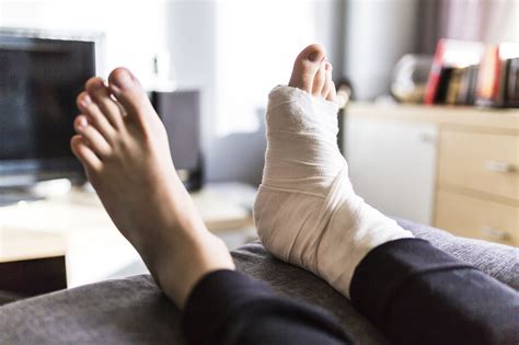 Tips For Boosting Your Recovery After Ankle Surgery Thomas A