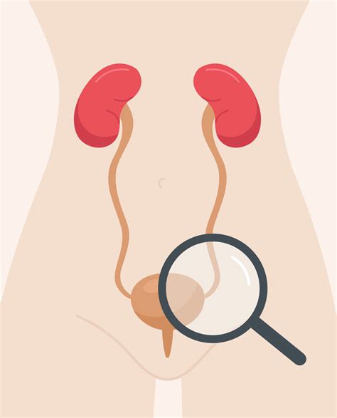 Urinary Tract Infections Uti In Women Synappsehealth