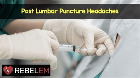 Post Lumbar Puncture Headaches Rebel Em Emergency Medicine Blog