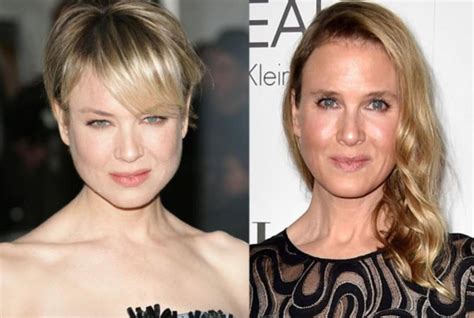 Hollywood Top Stars Celebrity Faces Plastic Surgery How Can Done