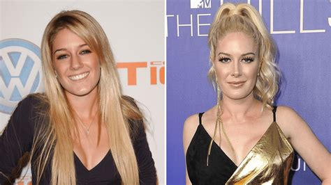 Heidi Montag Plastic Surgery Photos Of Her Before And After Life And Style