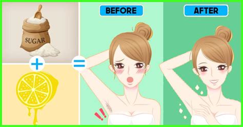 Remove armpit hair with happydermaco cost less than waxing and shaving combined. How To Remove Underarm Hair (Armpit Hair) At Home