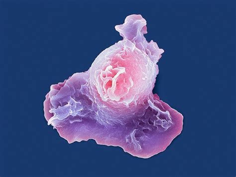 Neutrophil White Blood Cell Sem Bild Kaufen 12492202 Science Photo