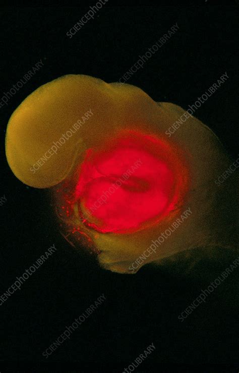 Embryo At Five Weeks Light Micrograph Stock Image C0487926