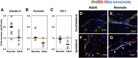 Bloodbrain Barrier Permeability Is Increased After Acute Adult Stroke